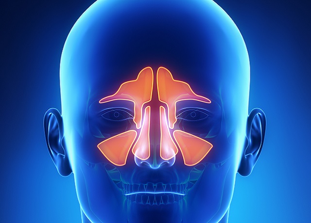 Chronic rhinosinusitis